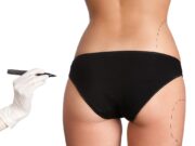 Коррекция фигуры методика Body FX